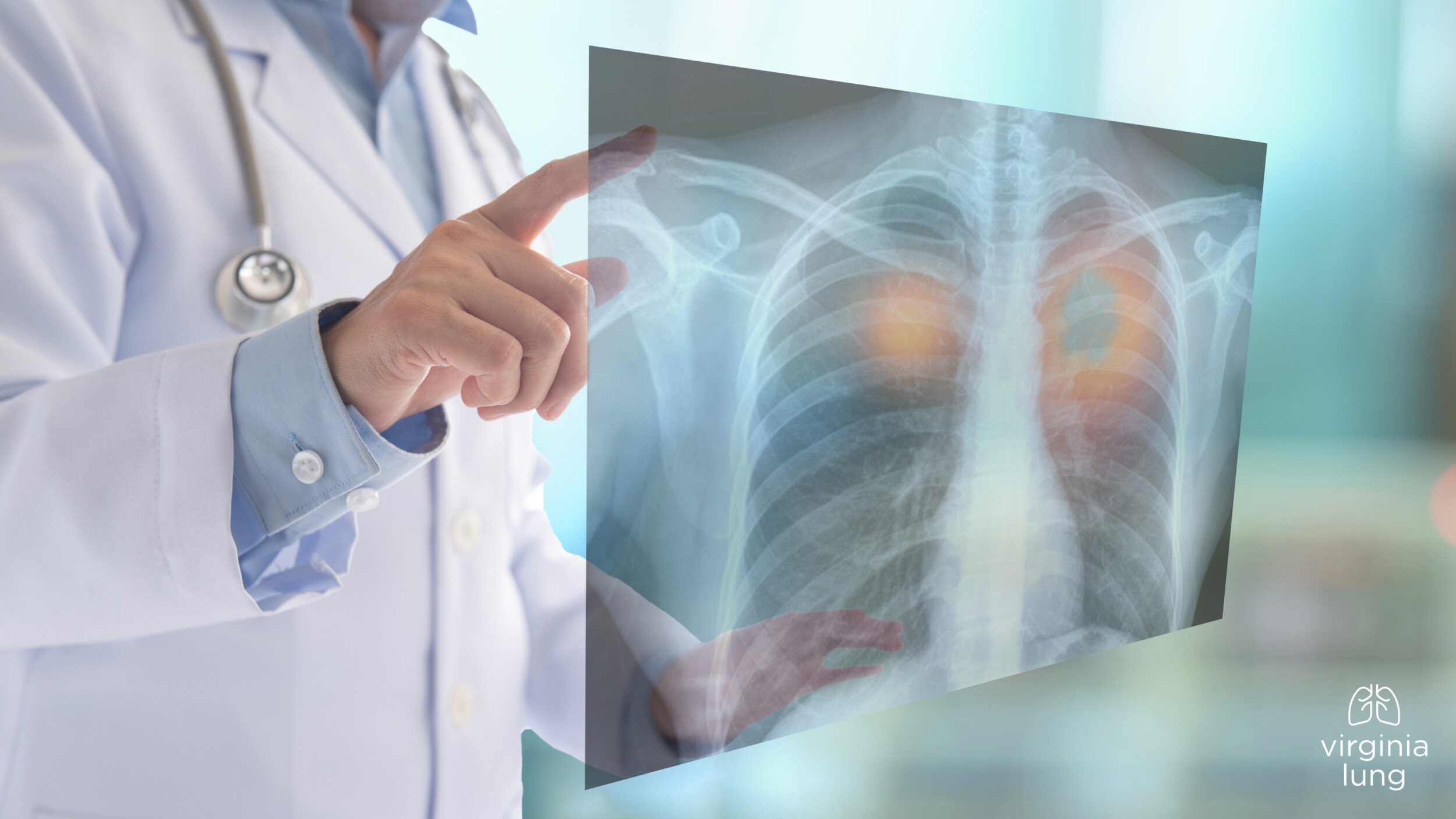 Spotting the Early Signs of Lung Cancer